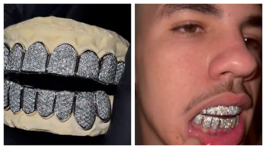 LaMello Got Grillz