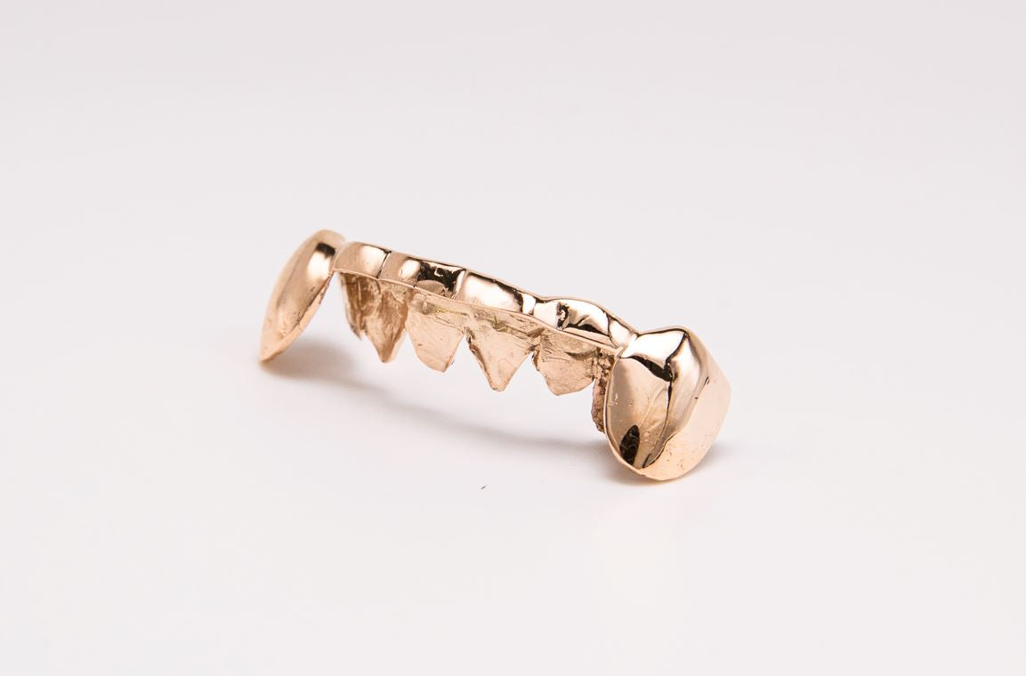 The Bridge - Rose Gold 2 Teeth Cap, 6 Tooth Bridge