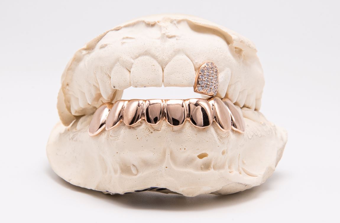 The Jimmy - Rose Gold 9 Teeth