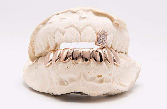 The Jimmy - Rose Gold 9 Teeth