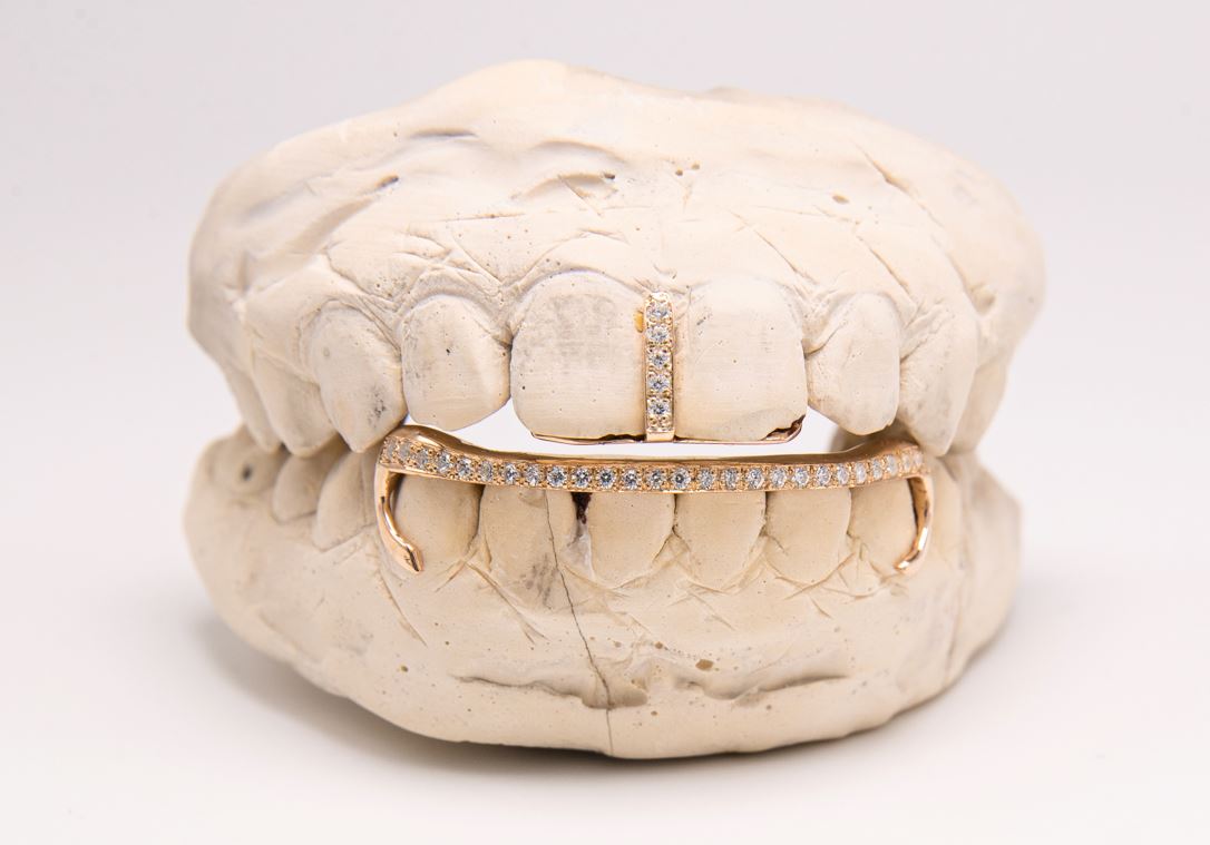 The Kim K - Rose Gold 2 Piece Grillz