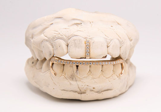 The Kim K - Rose Gold 2 Piece Grillz