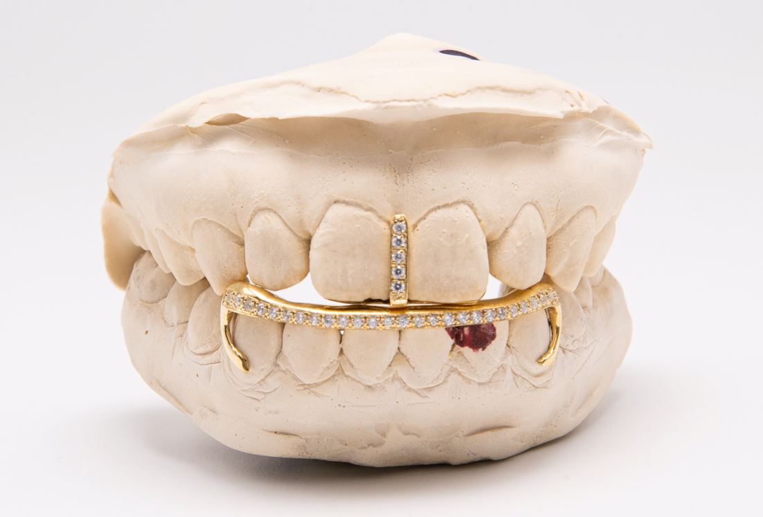 The Kim K - Yellow Gold 2 Piece Grillz