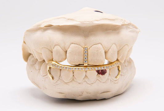 The Kim K - Yellow Gold 2 Piece Grillz