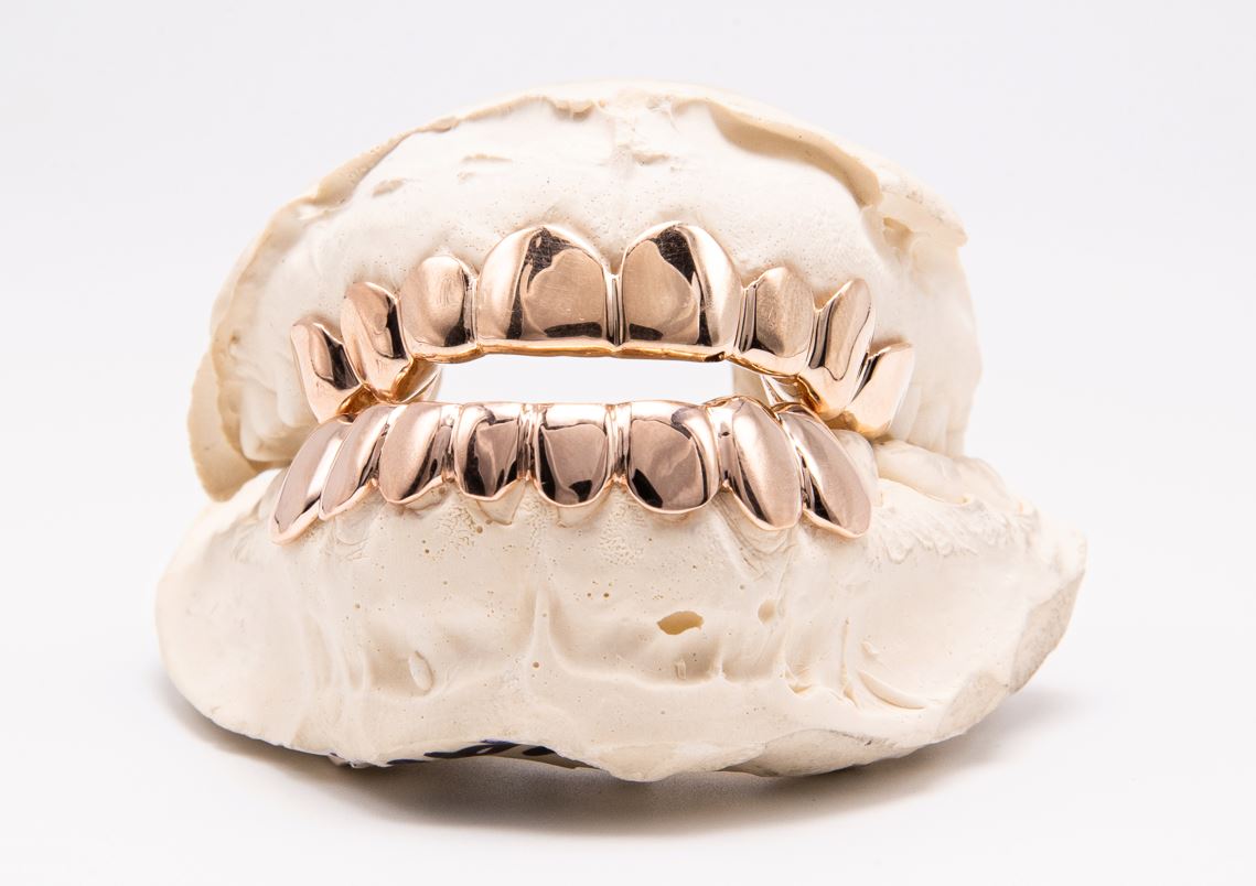 The Kodak - Rose Gold 16 Teeth