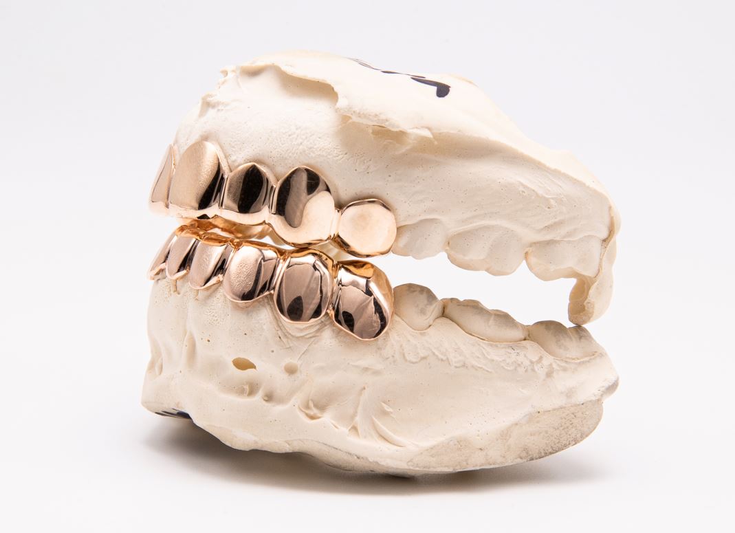 The Kodak - Rose Gold 16 Teeth