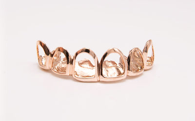 The Open Soul - Rose Gold 6 Outlined Teeth
