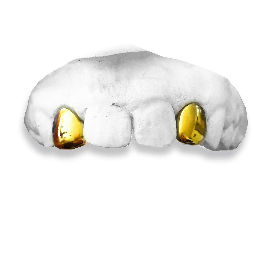 The OG-yellow-gold-custom-grillz