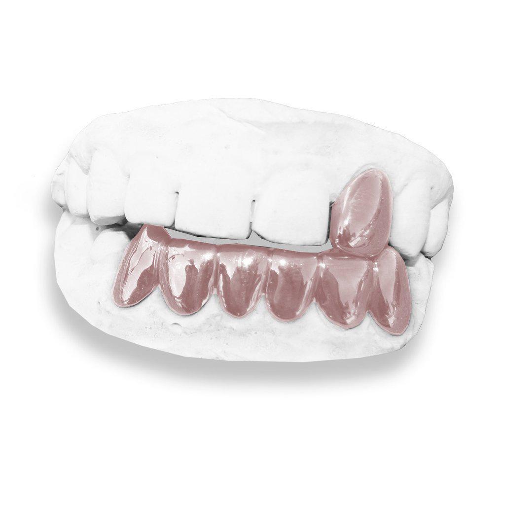 The Street Kid-rose-gold-custom-grillz