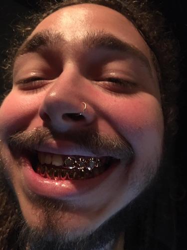 Post Malone's custom gold grillz made by Grillz.com