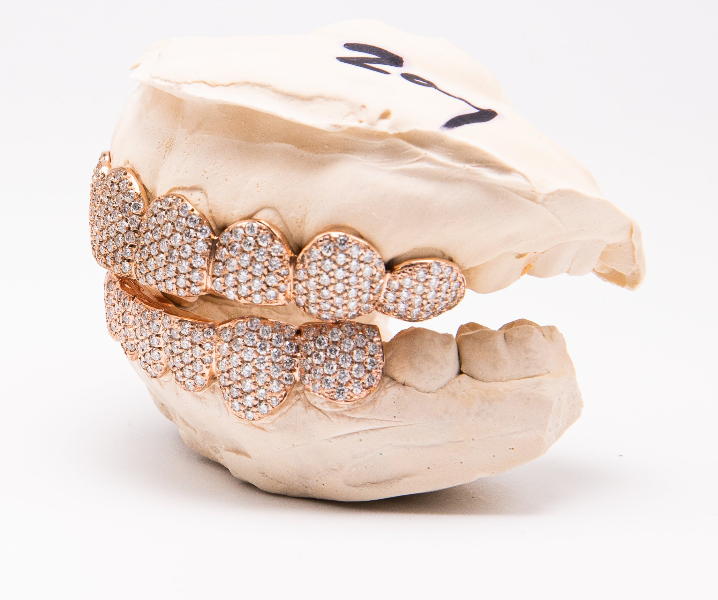 The Snow Cone - 16 Teeth Rose Gold Fully Iced