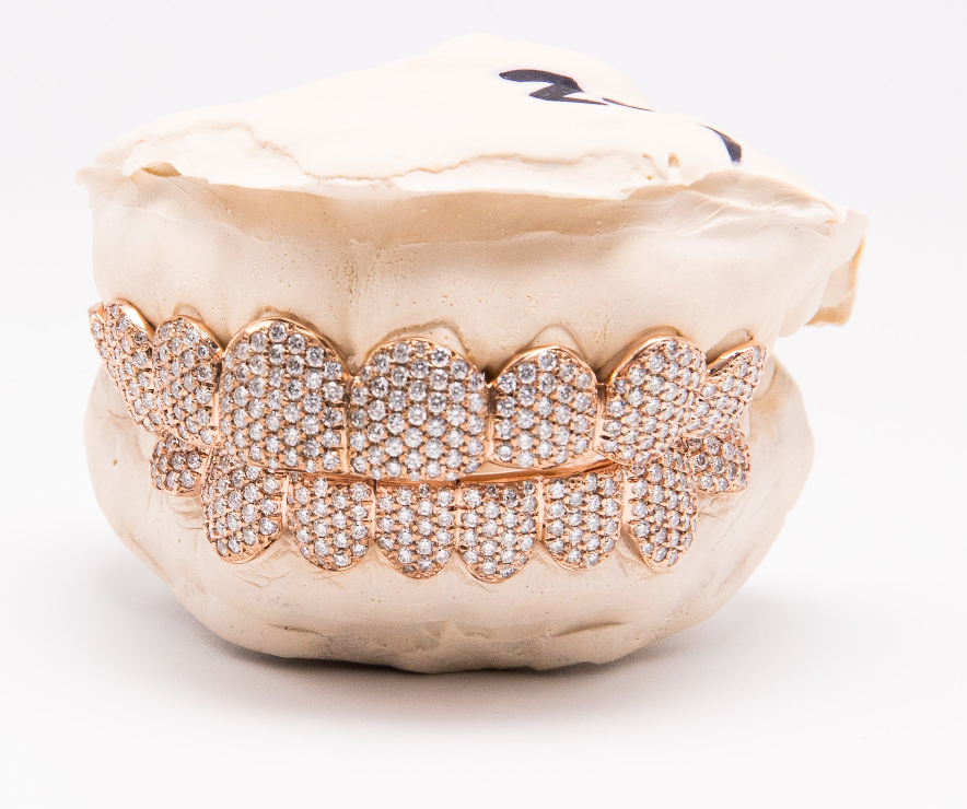 The Snow Cone - 16 Teeth Rose Gold Fully Iced