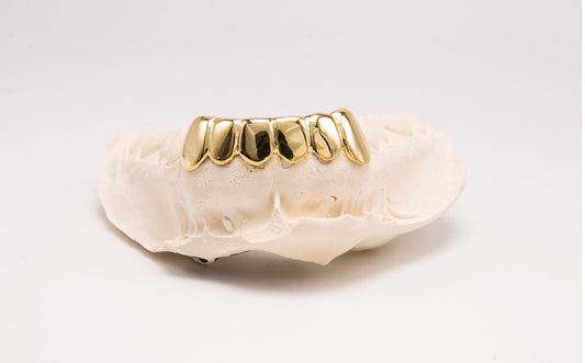 The Classic - Yellow Gold 6 Teeth