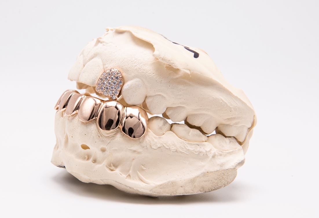 The Jimmy - Rose Gold 9 Teeth