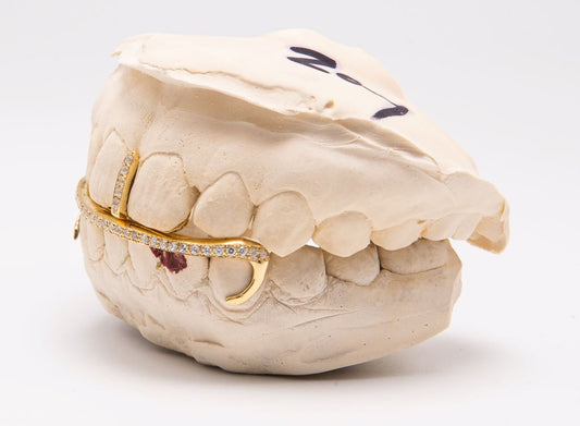 The Kim K - Yellow Gold 2 Piece Grillz