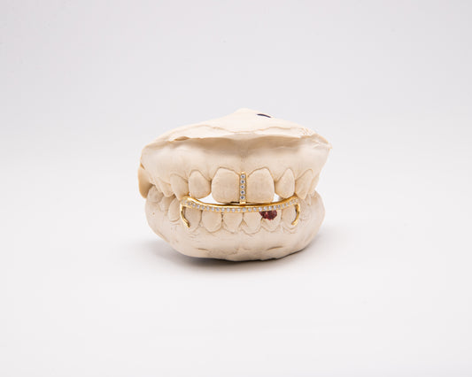 The Kim Kardashian-silver-custom-grillz