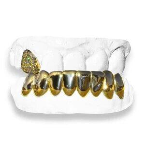 The Jimmy-yellow-gold-grillz