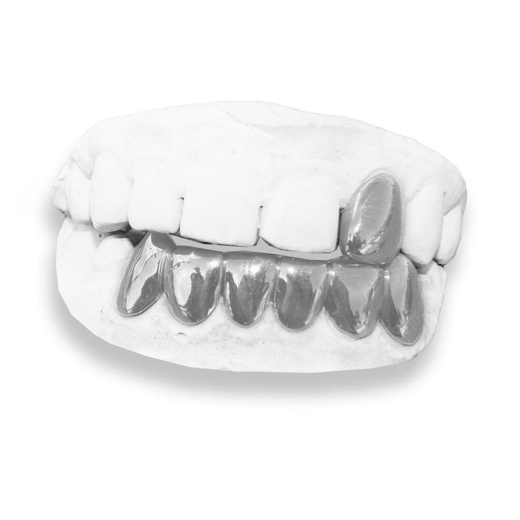 The Street Kid-white-gold-custom-grillz