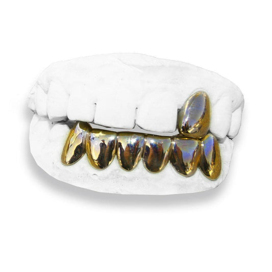 The Street Kid-yellow-gold-custom-grillz