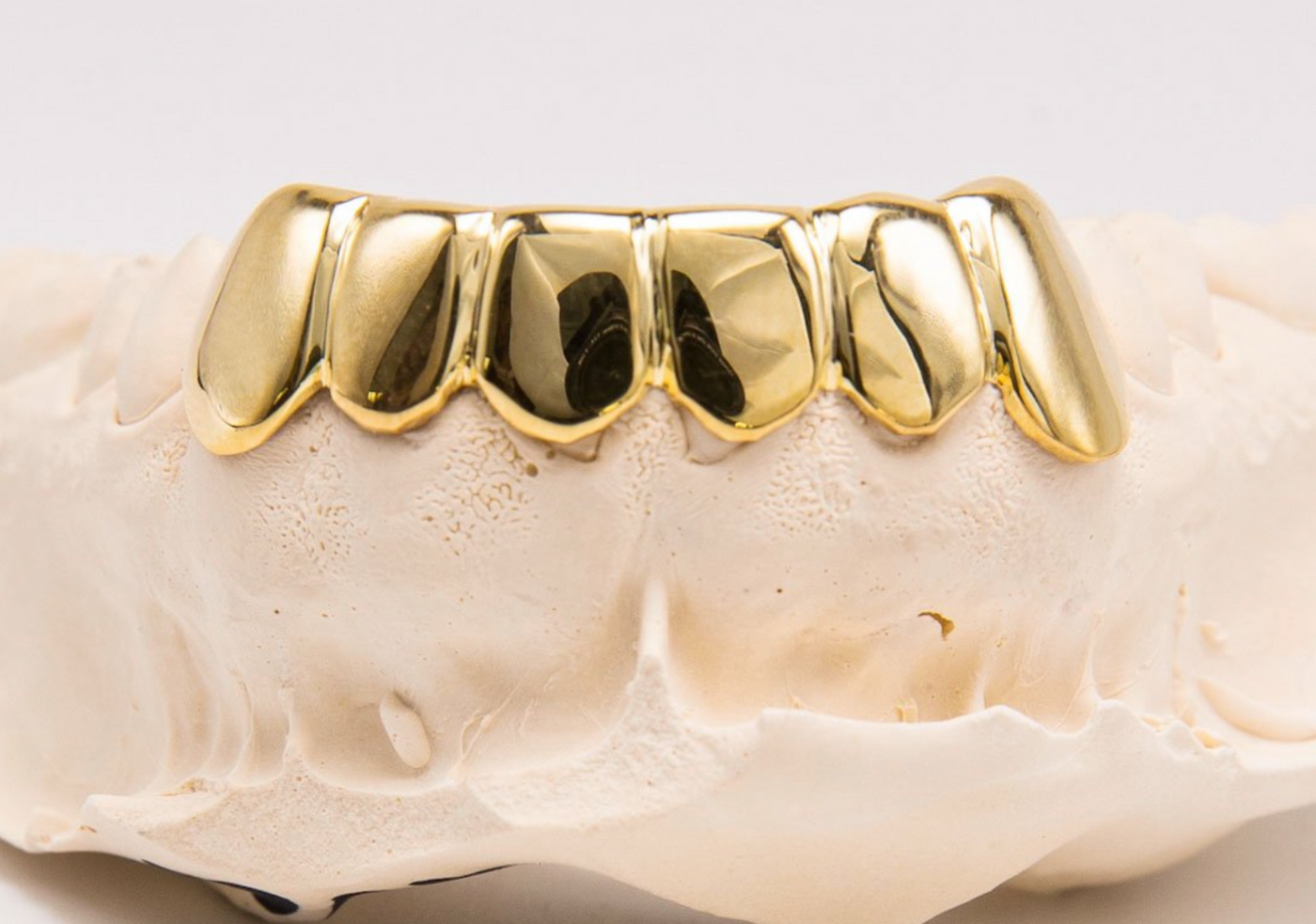 Do It Your Self Mold Kit - Gold Grillz Miami Official Website (305) 989-6479